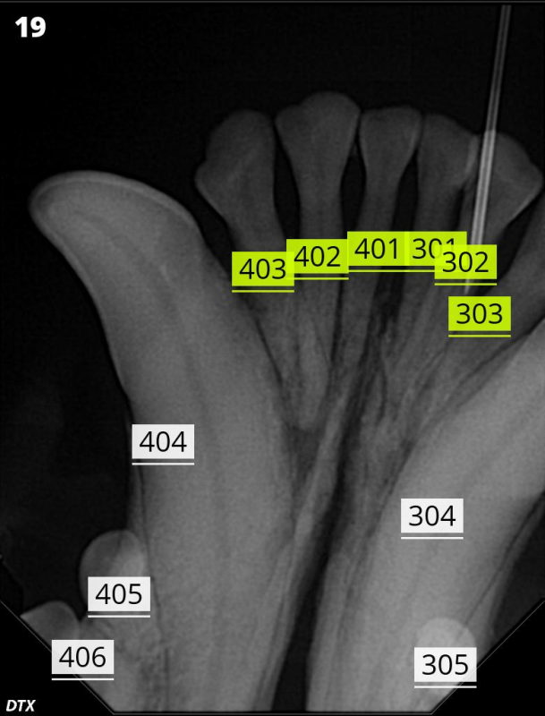 Click the image to toggle annotations.